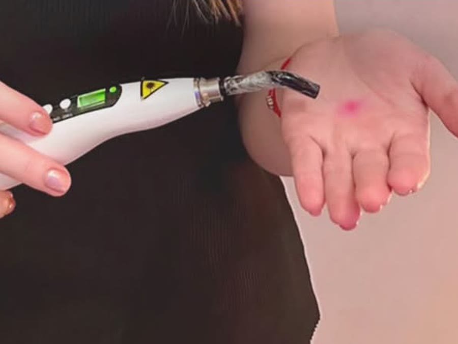 Caneta de laser de baixa intensidade apontada para a palma da mão