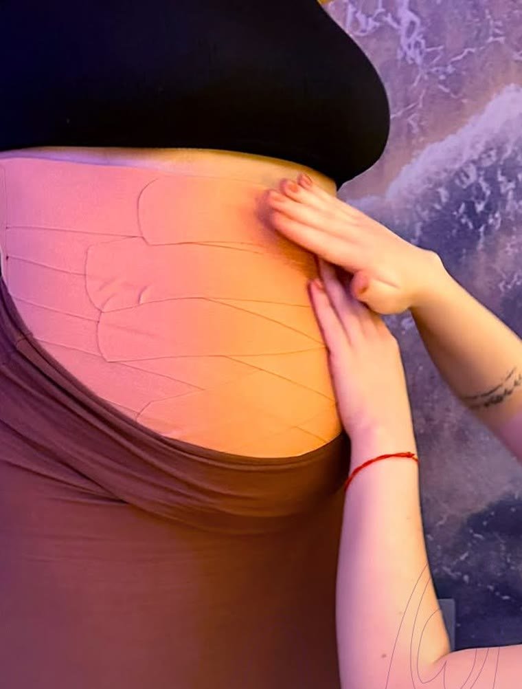 Bandagens de taping aplicadas na barriga de uma gestante, com as mãos da profissional ajustando a fita